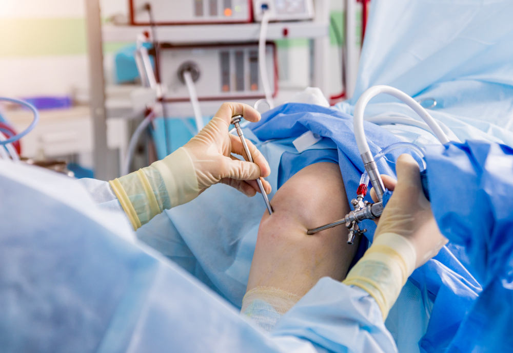 ACL Reconstruction Surgery in Pune