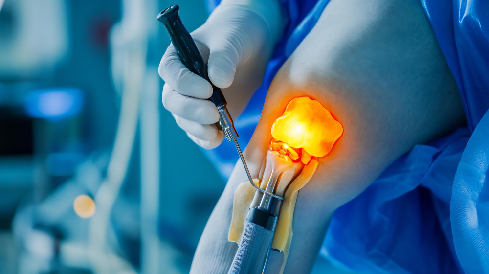 Meniscus Surgery Pune